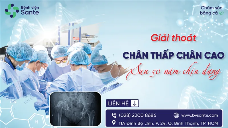 Giải thoát “chân thấp chân cao” sau 50 năm chịu đựng - Bệnh viện SANTE Bình Thạnh, TP.HCM Giải thoát “chân thấp chân cao” sau 50 năm chịu đựng - Bệnh viện SANTE Bình Thạnh, TP.HCM