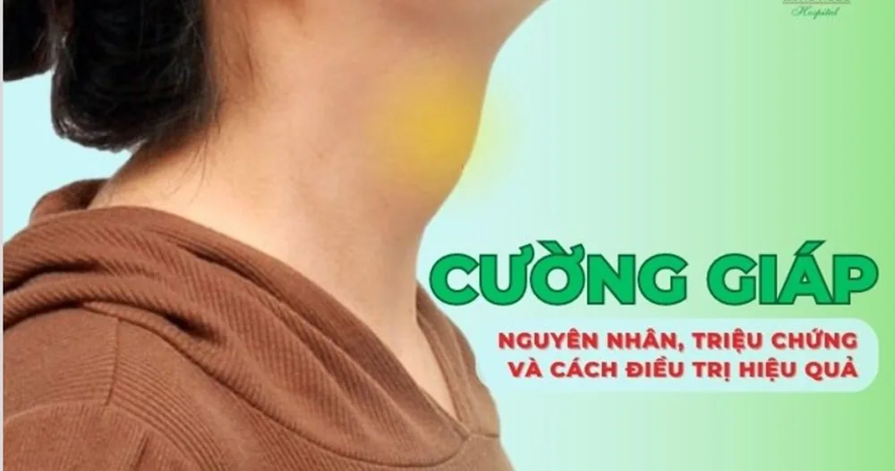 Bệnh viện Sante - Cường giáp là bệnh gì? Nguyên nhân_ dấu hiệu và cách chữa trị (Hình 4)