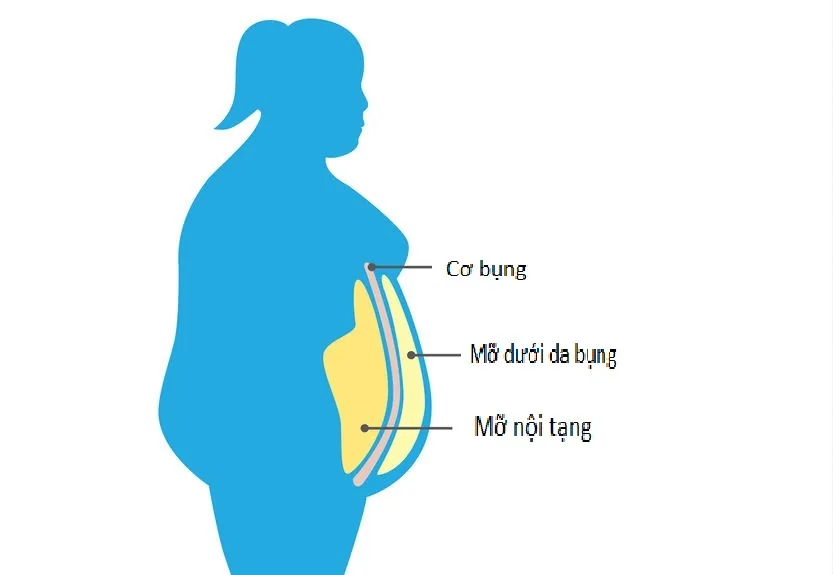 NGUYÊN NHÂN GÂY MỠ NỘI TẠNG - Hình 3 - Bệnh viện SANTE Bình Thạnh, TP.HCM NGUYÊN NHÂN GÂY MỠ NỘI TẠNG - Hình 3 - Bệnh viện SANTE Bình Thạnh, TP.HCM