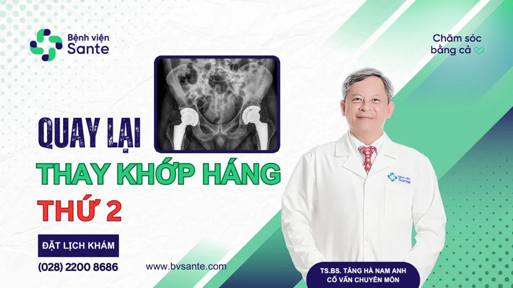 Quay lại thay khớp háng thứ 2 sau 1 tháng - Bệnh viện SANTE Bình Thạnh, TP.HCM Quay lại thay khớp háng thứ 2 sau 1 tháng - Bệnh viện SANTE Bình Thạnh, TP.HCM
